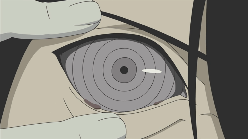 Then he put in his eye with no surgery.